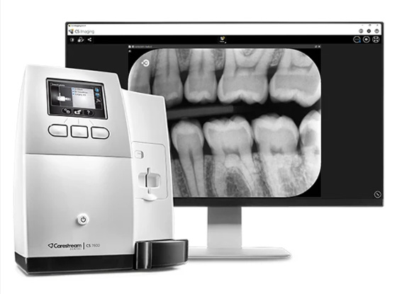 Carestream fosforpladescanner CS7600
