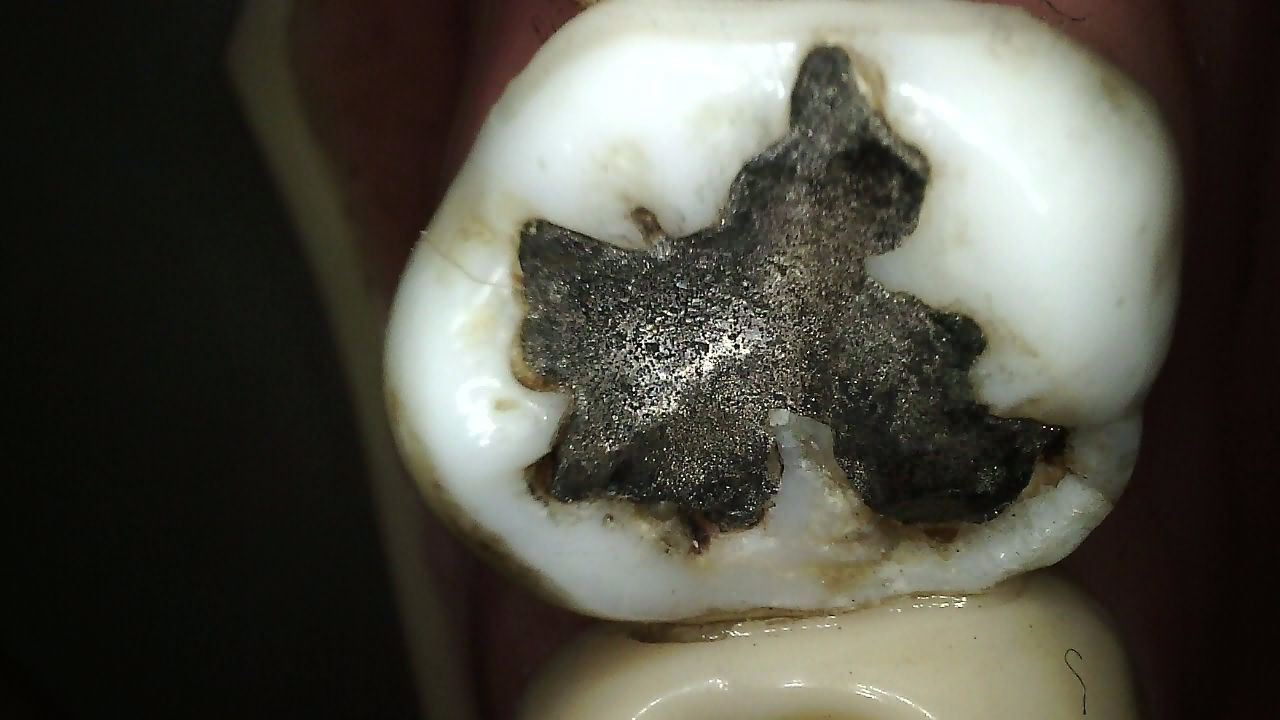 Klinisk billede taget med CS 1300