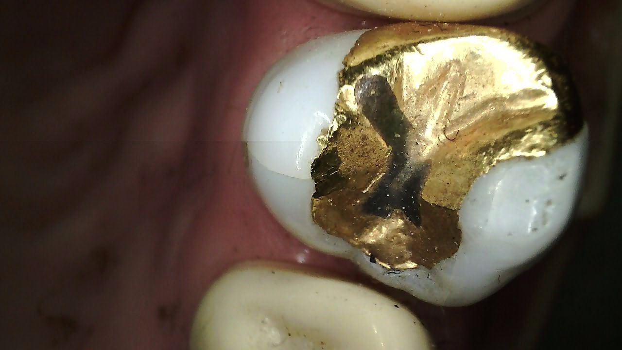 Klinisk billede taget med CS 1300