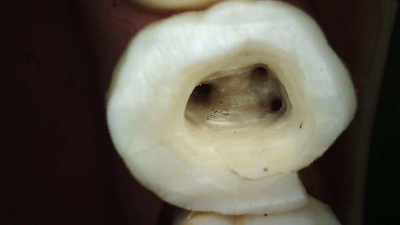 Klinisk billede taget med CS 1300