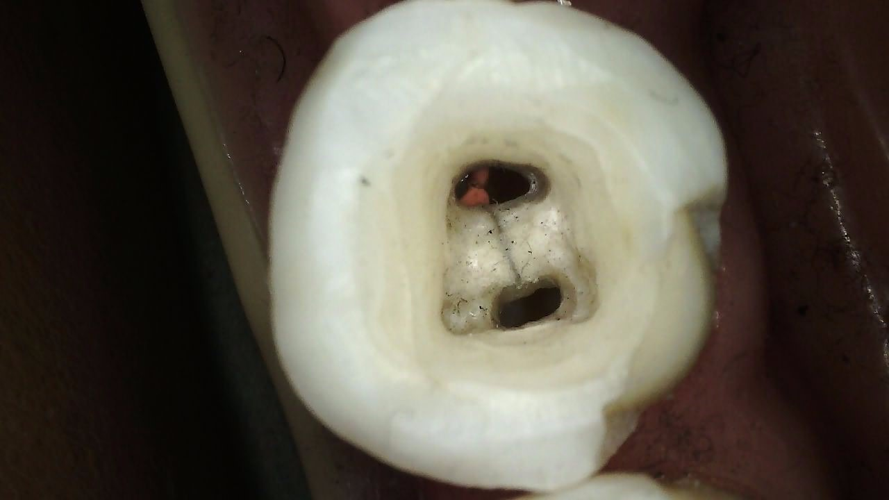 Klinisk billede taget med CS 1300