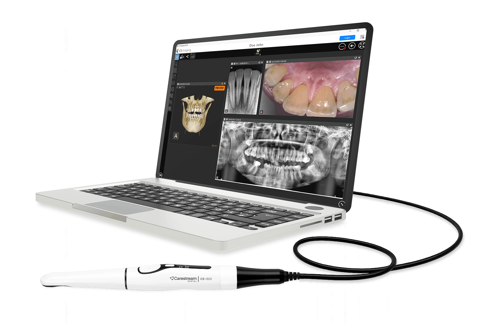 CS 1300 tilsluttet CS Imaging 8