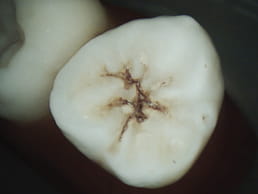 Klinisk billede taget med CS 1500