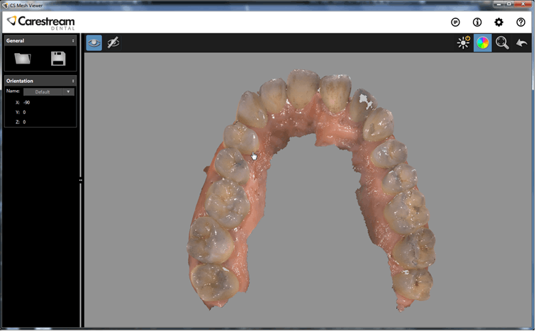 CS 3600 fuldt kæbeskannresultat som 3D-model