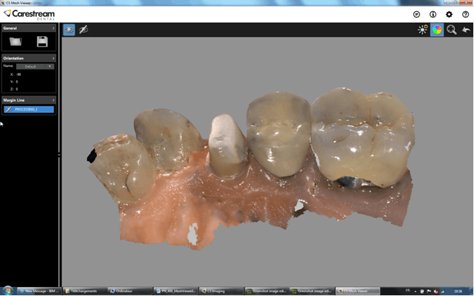 CS 3600 sektorskanning til restaurering
