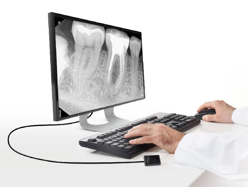 Tandlæge gennemgår periapikalt billede på monitor med RVG 5200 tilsluttet