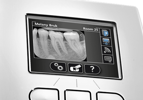 CS 7600 LCD-display med billedforhåndsvisning og patientdata
