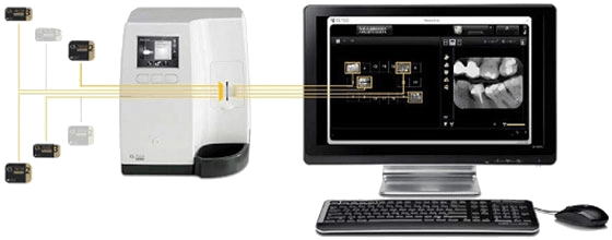 CS 7600 Scan & Go netværksdiagram — skanner sender billeder direkte til PC