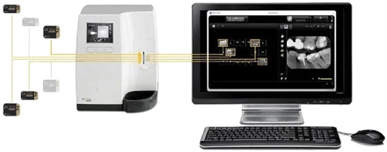 CS 7600 Scan & Go netværksdiagram — skanner sender billeder direkte til PC