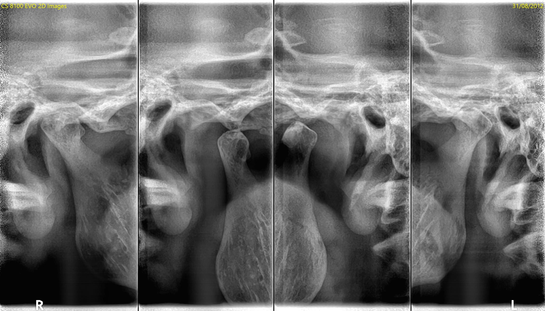 CS 8100SC TMJ-optagelse