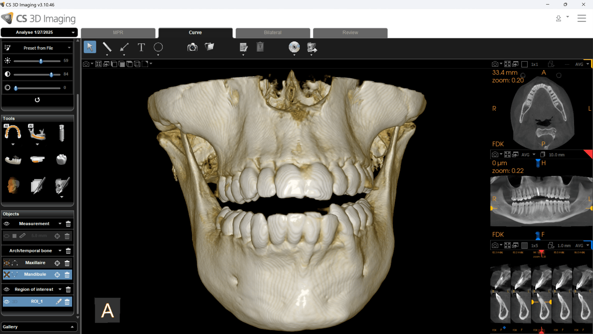 CS 8200 3D 16×10 cm FOV — frontal