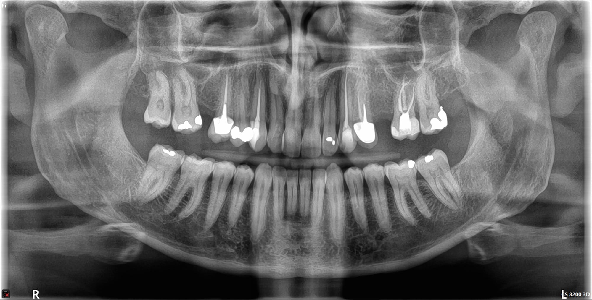 CS 8200 3D panoramabillede