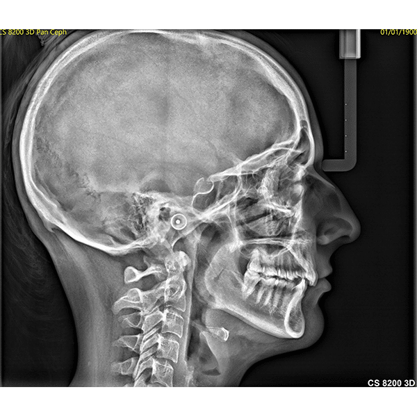 Klinisk ceph-resultat