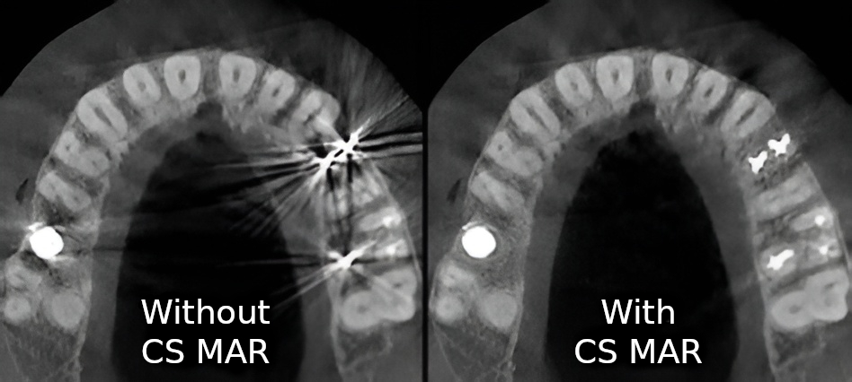 CS MAR metalstøjreduktion — med og uden