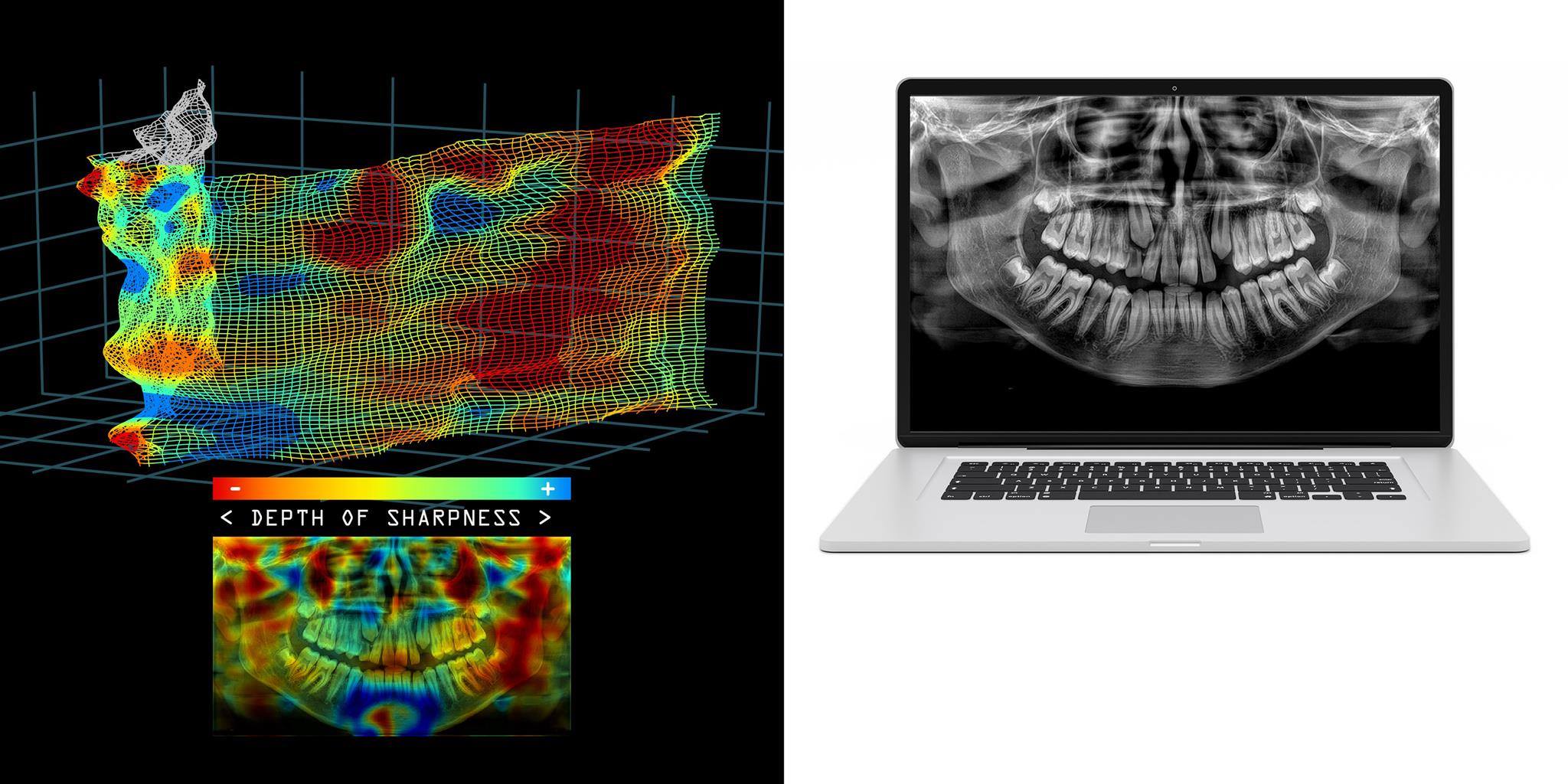 Tomosharp panoramarekonstruktion