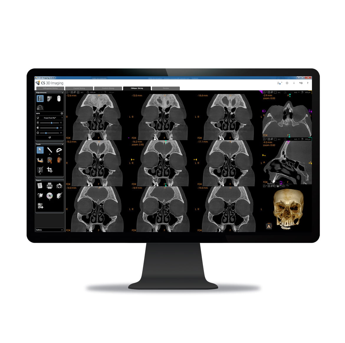 CS 9600 sinus- og ENT-optagelse