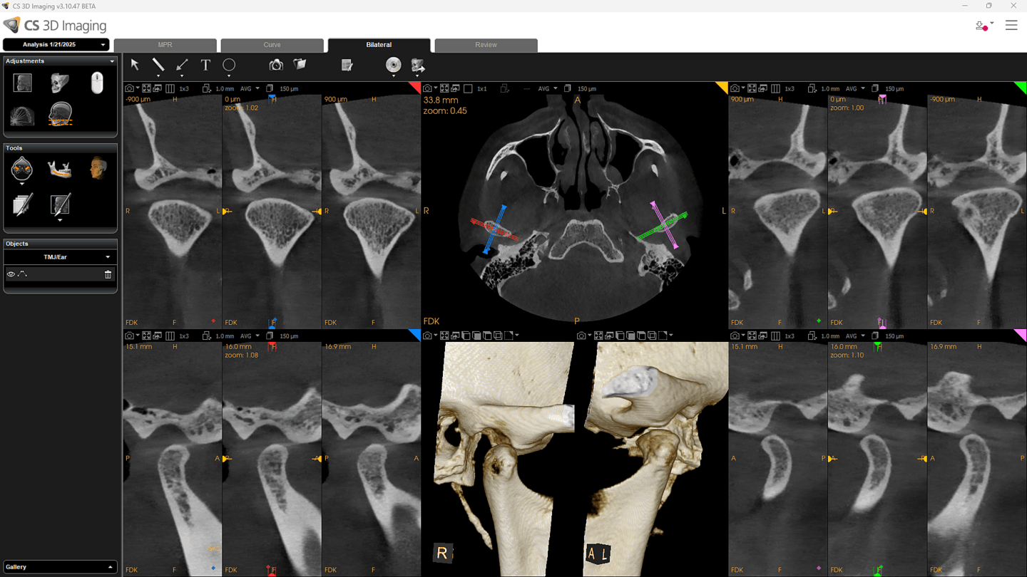 CS 9600 TMJ-optagelse 16×6 cm