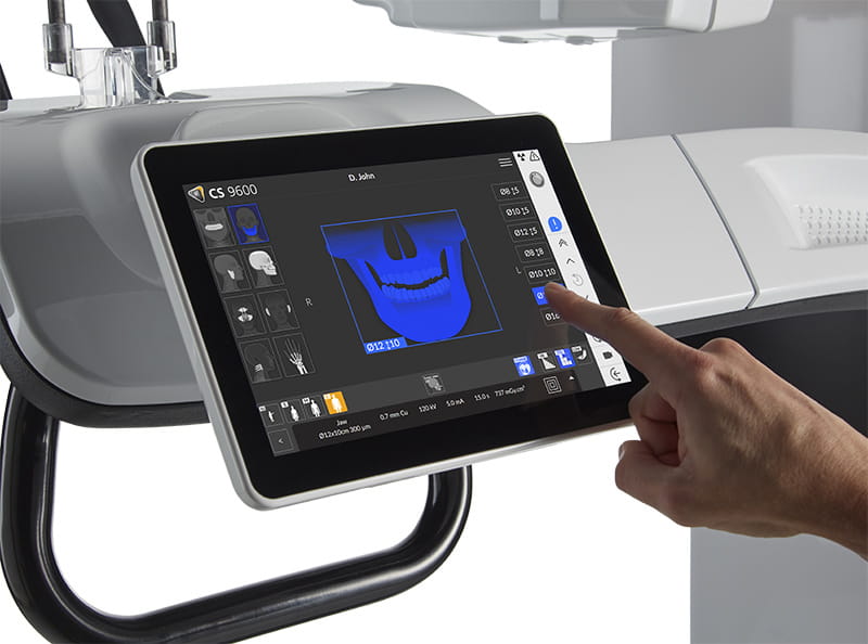CS 9600 SmartPad touchskærm
