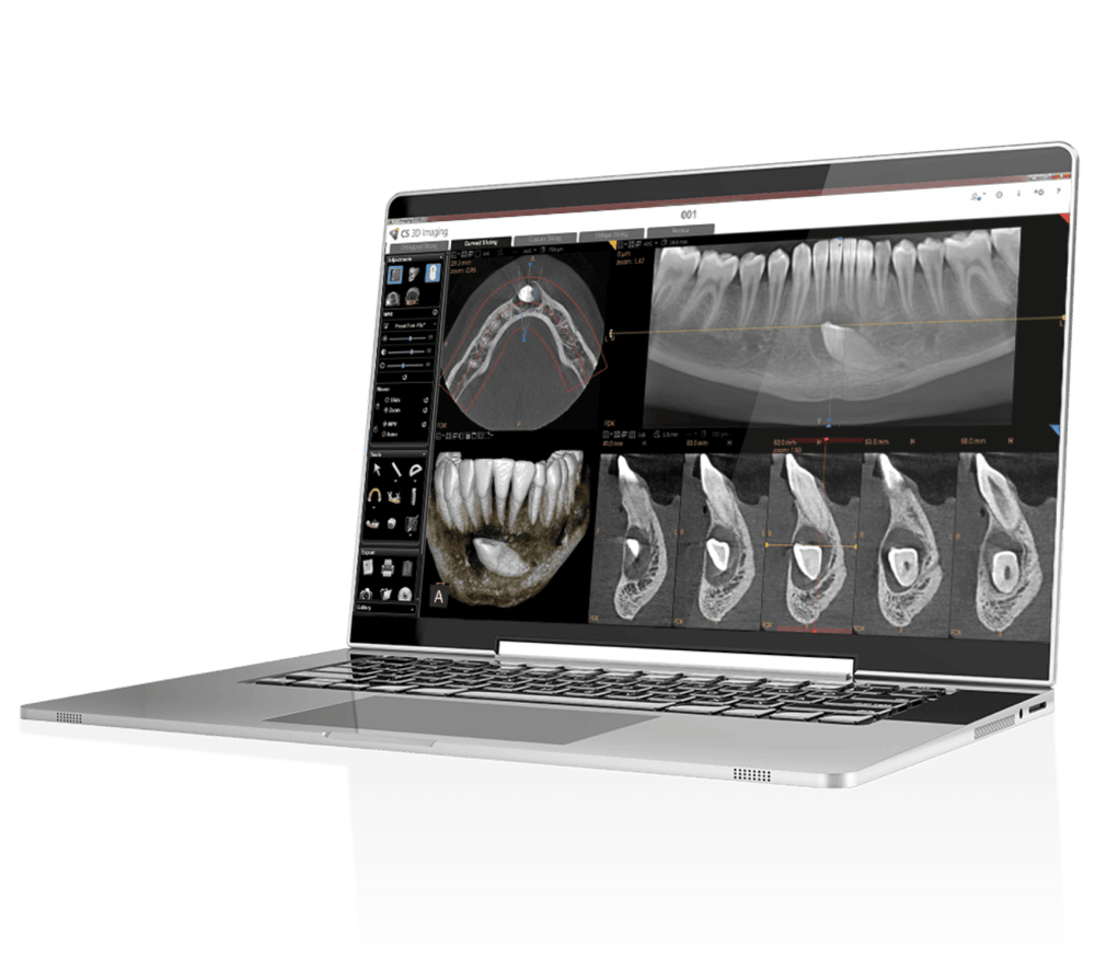 CS 3D Imaging på laptop