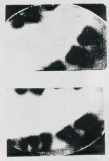 Verdens første bitewing-billede