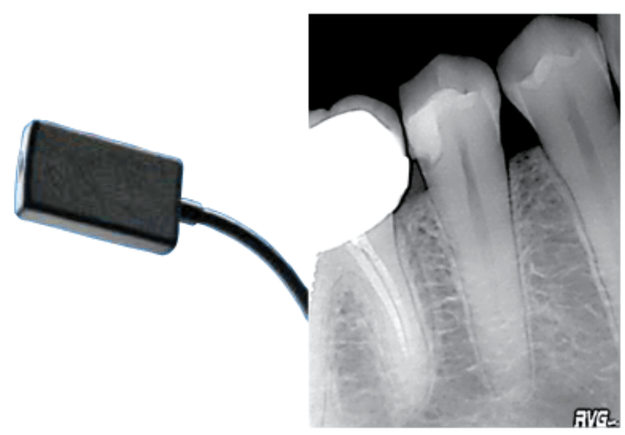 The first digital xray sensor