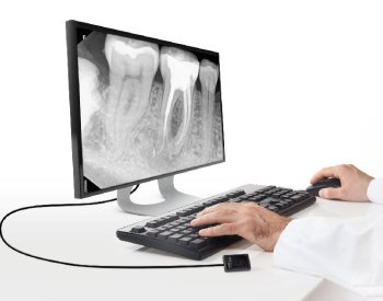 Dentec anbefaler Carestreams RVG 5200. Kontakt os i dag, og hør mere om mulighederne ved en intraoral sensor